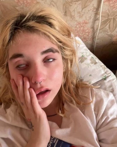 Сплитики